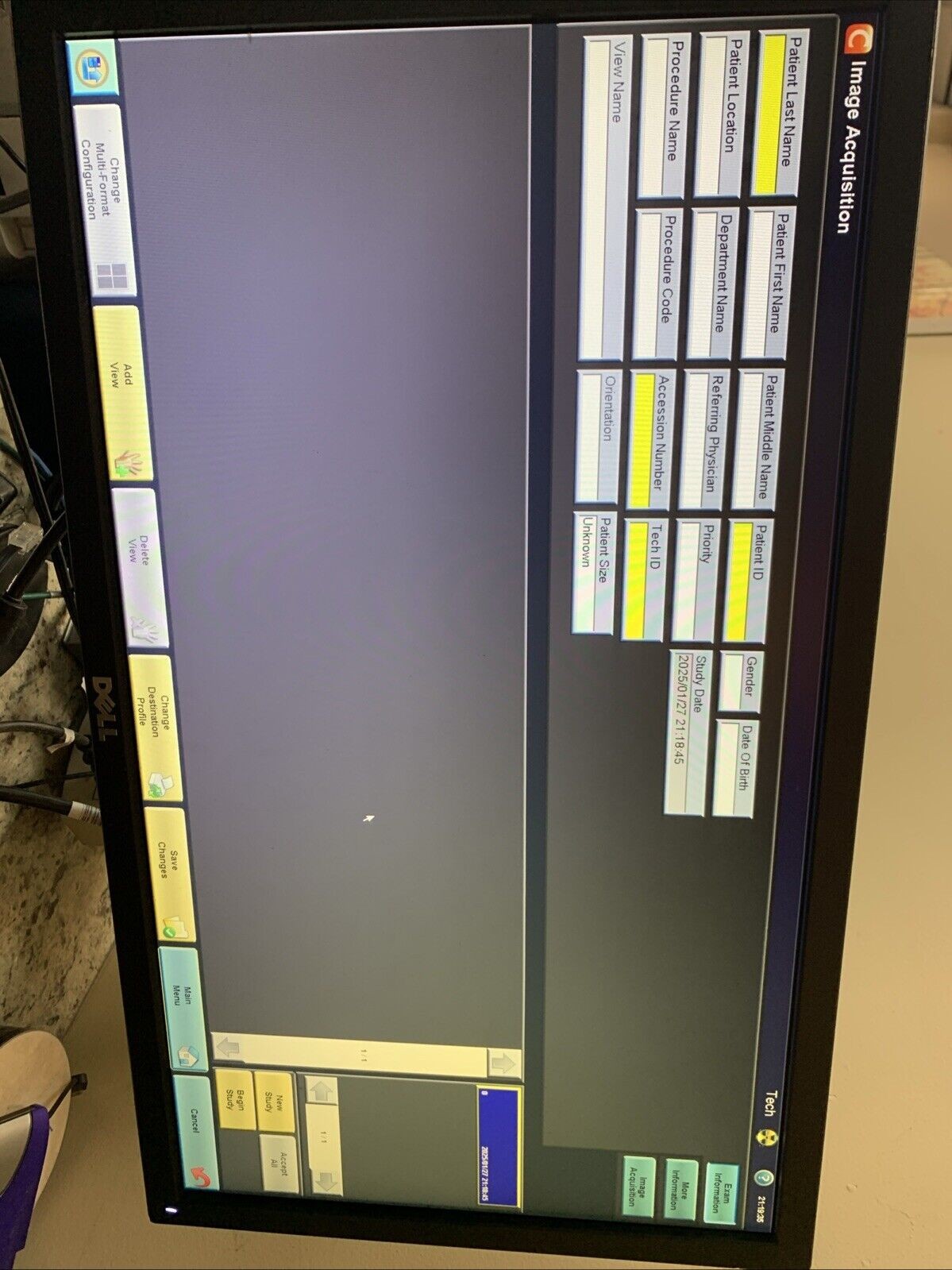 Carestream DRX-1 System computer & more