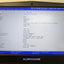 Dell Alienware 15.6" 15 R2 Laptop FHD LCD Screen Complete Assembly (Side Dent) -